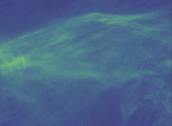 MDW image with star removal