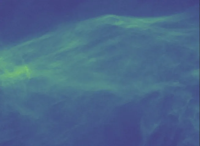 MDW image with star removal